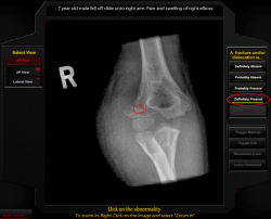 Photograph of ImageSim system showing step in diagnosing an Xray case